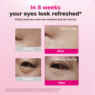 ISOI Blemish Care Eye & Wrinkle Patch