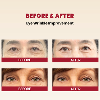 KSecret Seoul 1988 Eye Cream: Retinal Liposome 4% + Fermented Bean